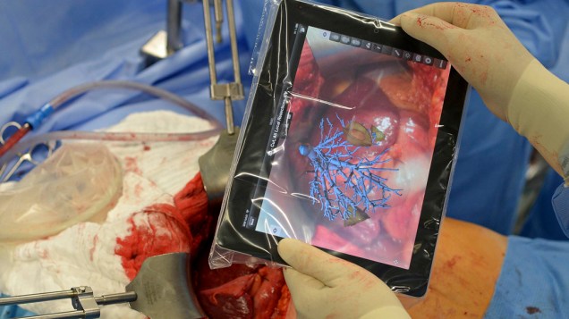 A tela do tablet adiciona camadas de dados às informações que o cirurgião pode ver naturalmente, ajudando no procedimento