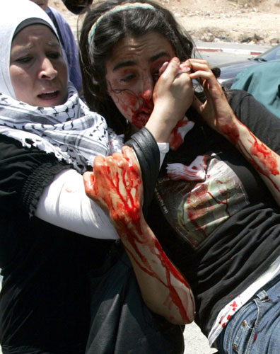 Ativista é ferida durante protesto contra Israel, na Cisjordânia.