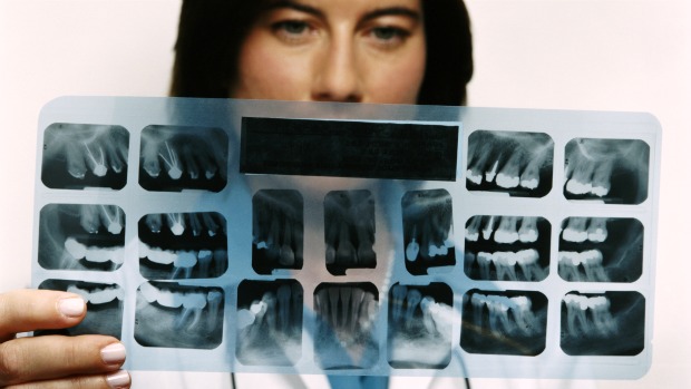 Raio-X: mandíbulas inferiores com estrutura óssea escassa podem prever o risco de fraturas em outros ossos do corpo