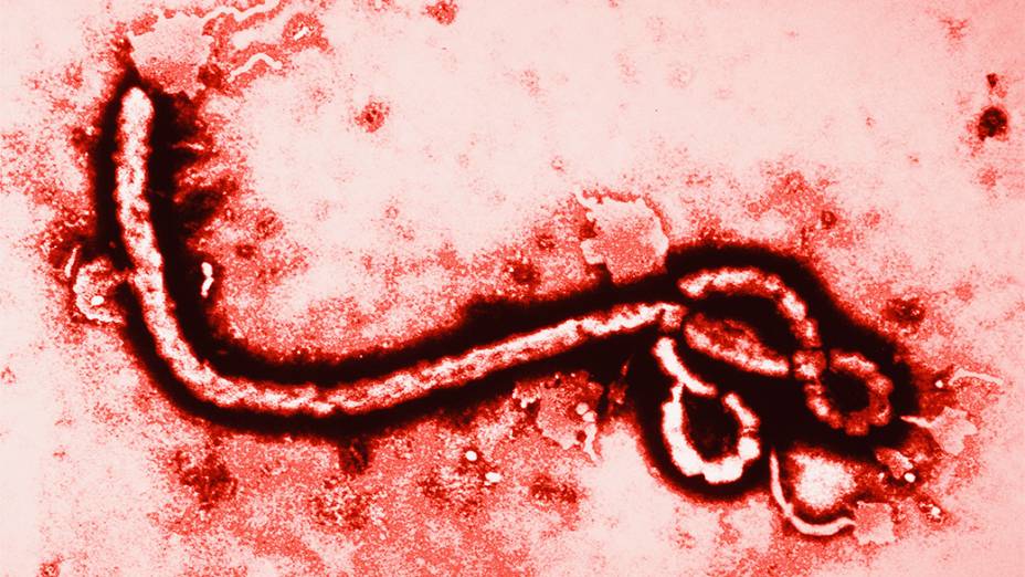 Vírus causador do Ebola