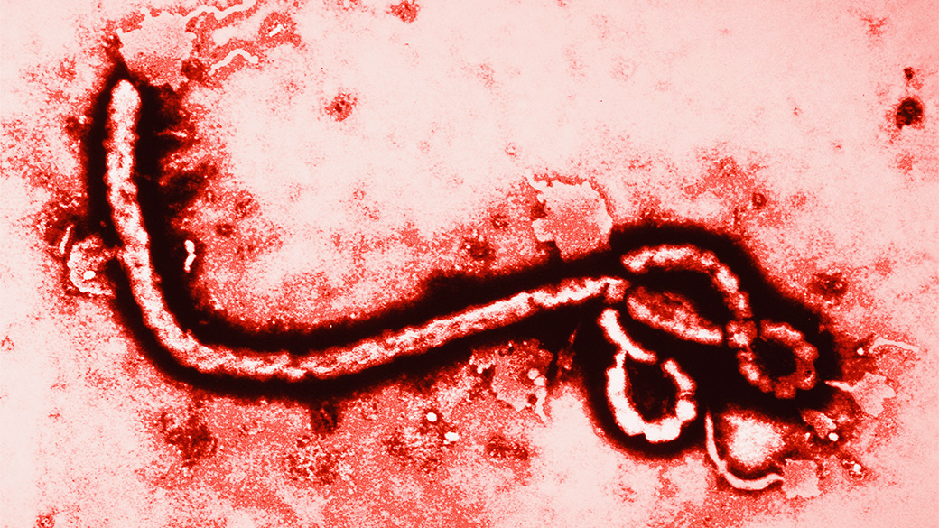 Vírus causador do Ebola