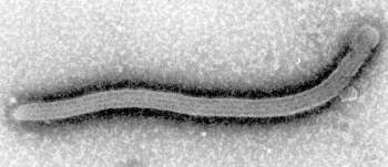 Foto de um vírus ebola tirada em um microscópio eletrônico