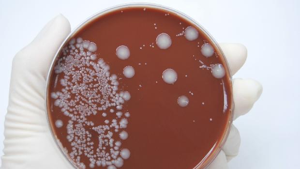 Surte de E. coli: nova cepa da bactéria é resistente a antibióticos e tóxica ao organismo