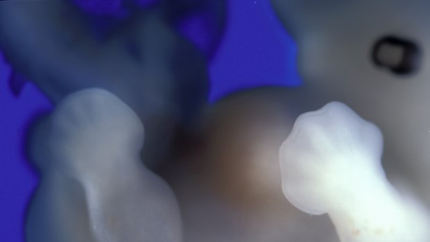 Embrião humano de 40 dias: em laboratório, os chineses modificaram os genes nesse estágio de desenvolvimento