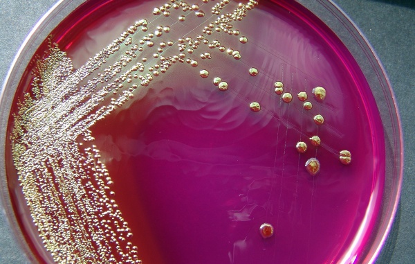 A bactéria Escherichia coli cultivada em uma placa de petri