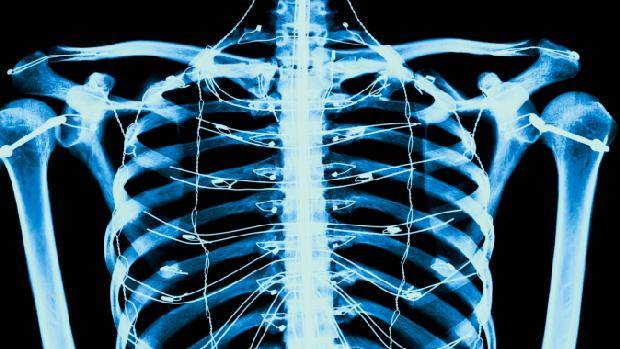Conheça 5 partes do corpo que foram descobertas nos últimos anos