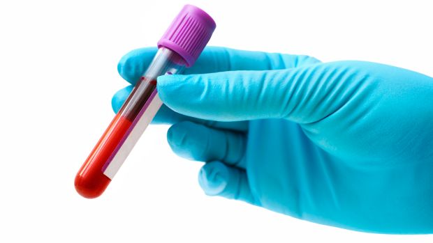 Diagnóstico precoce: A partir de exame de sangue, cientistas sul-coreanos procuram alteração em determinado gene para detectar a doença de forma não invasiva