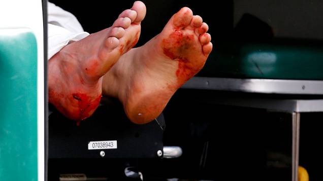 Pés sujos de sangue, após a explosão na maratona de Boston que deixou duas pessoas mortas