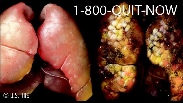Advertência: fumar pode causar doenças fatais do pulmão