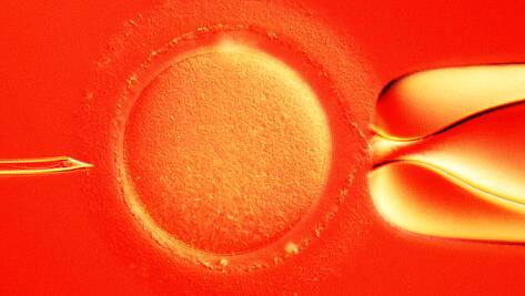Brasil: clínicas de reprodução assistida congelaram 38 062 embriões em 2013