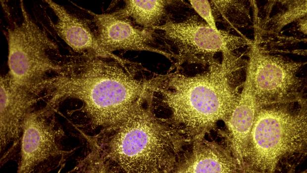 Fibroblastos, as células usadas na experiência dos pesquisadores suecos