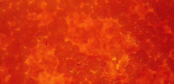 Glóbulos vermelhos (hemácias)