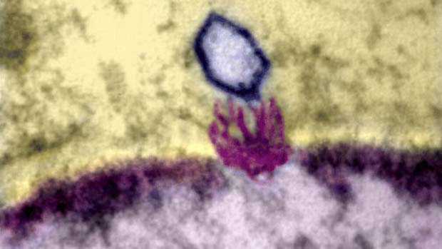 Vírus do herpes prestes a injetar seu DNA no núcleo de uma célula (representado em roxo)