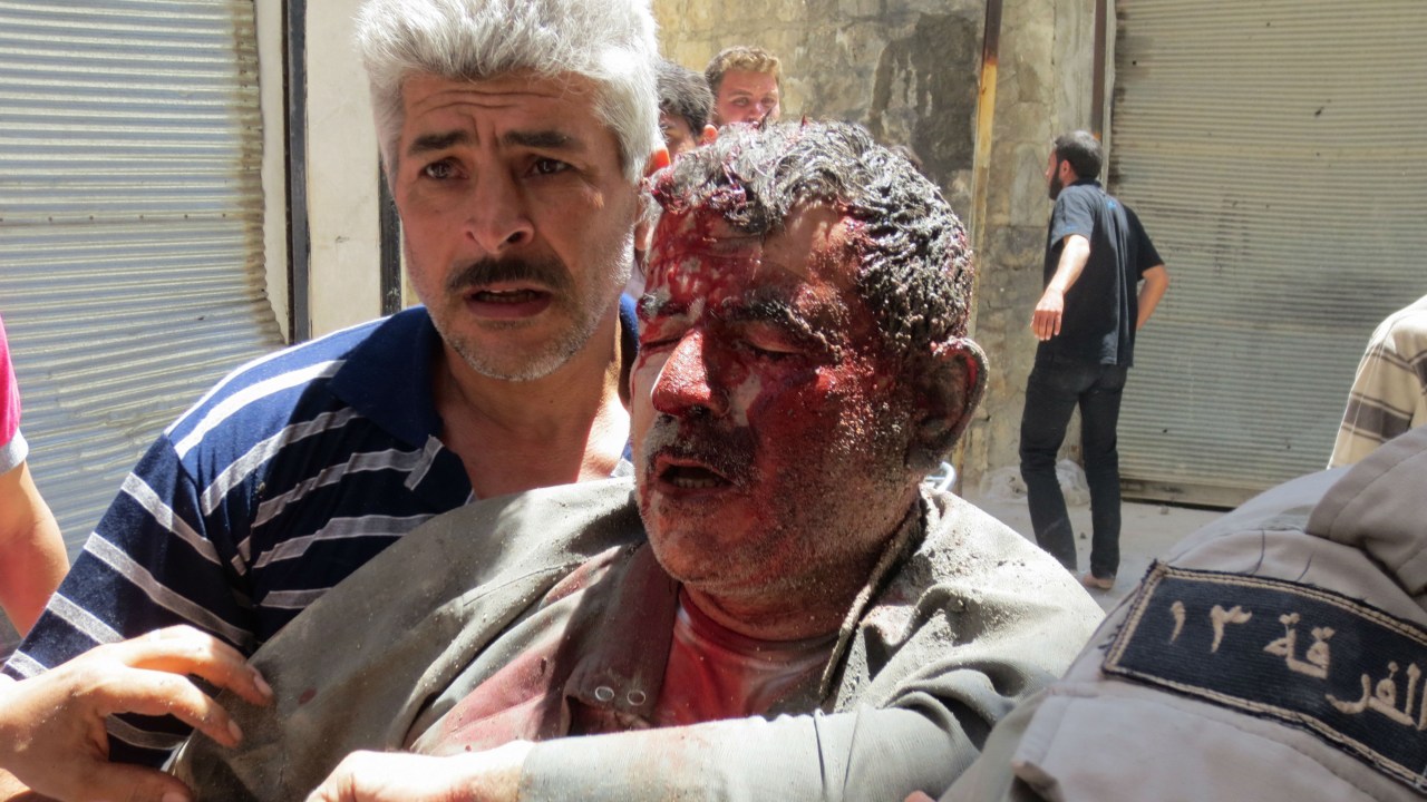 Homem ferido é amparado após sobreviver a ataque na Síria