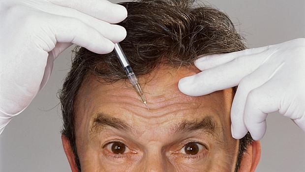 Além da procura pela remoção definitiva de pelos, os homens brasileiros que buscam algum procedimento estético querem apenas minimizar os danos causados pelo envelhecimento e não apagá-los completamente