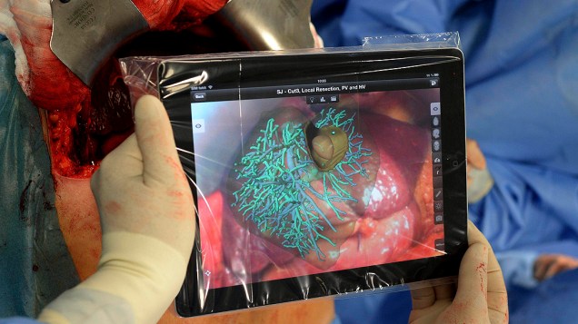 Equipe médica alemã foi uma das primeiras em todo o mundo a realizar uma cirurgia com o auxílio de um tablet
