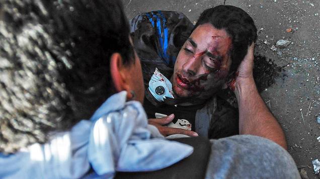 Estudante Bassil DaCosta ferido a tiros durante um protesto da oposição contra o governo do presidente, Nicolas Maduro, em Caracas, na Venezuela
