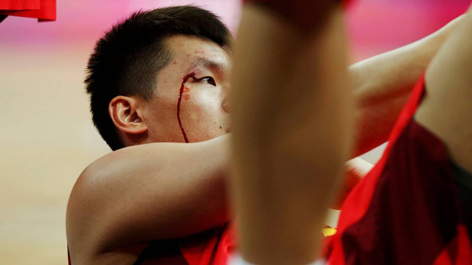 Chinês Zhu Fangyu sangra durante a preliminar de basquete do grupo B na competição da Australia contra China, em 02/08/2012