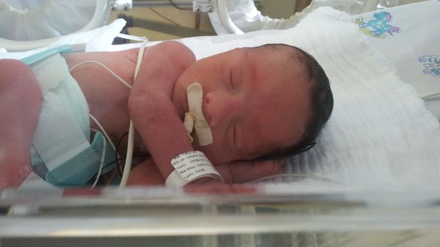 Joaquim Reis Ubaldino foi o primeiro bebê que recebeu a cirurgia desenvolvida pela médica brasileira Denise Pedreira para tratar espinha bífida. Ele foi operado ainda dentro do útero materno e nasceu em 15 de junho de 2013, aos sete meses de gestação