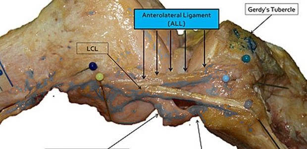 Imagem mostra o ligamento anterolateral (ALL) de um joelho direito