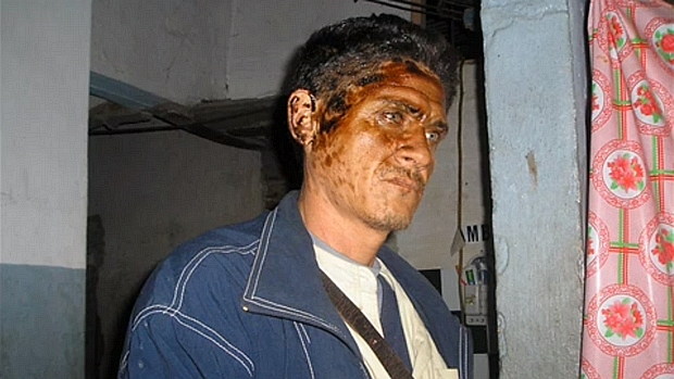 Em foto tirada na prisão, o dissidente cubano Jorge Cervantes aparece machucado