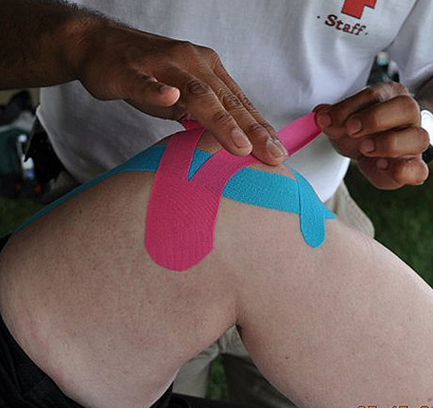 Kinesio tape