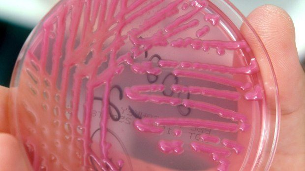 Cultura da bactéria KPC: Bactéria é resistente a antibióticos