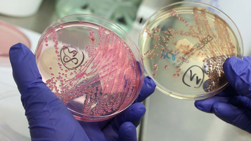 Surto de 'E. coli': investigações apontam que infecções na França e na Alemanha têm a mesma origem