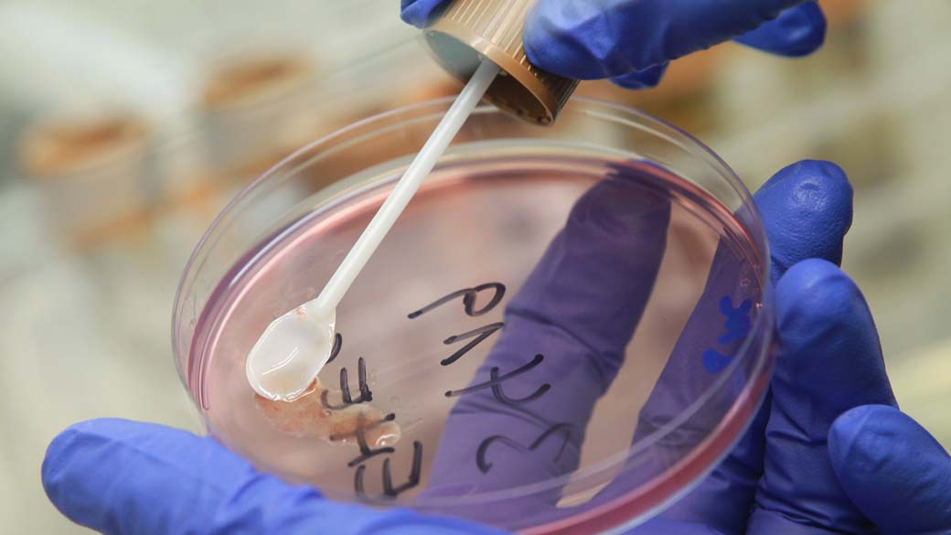 Autoridades de saúde da Alemanha procuram pistas do surto de E. coli enterohemorrágica (EHEC) a partir de cultura de bactérias de um paciente infectado