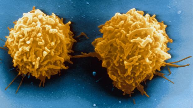 Os linfócitos T são células de defesa que protegem o nosso organismo de invasores como bactérias e vírus. Quando ocorre uma leucemia, estas células se multiplicam desordenadamente e se tornam cancerosas