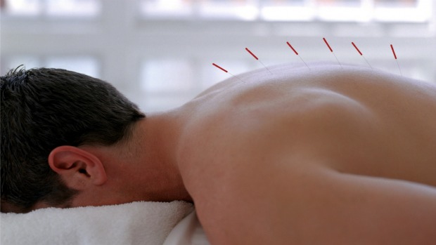 Acupuntura