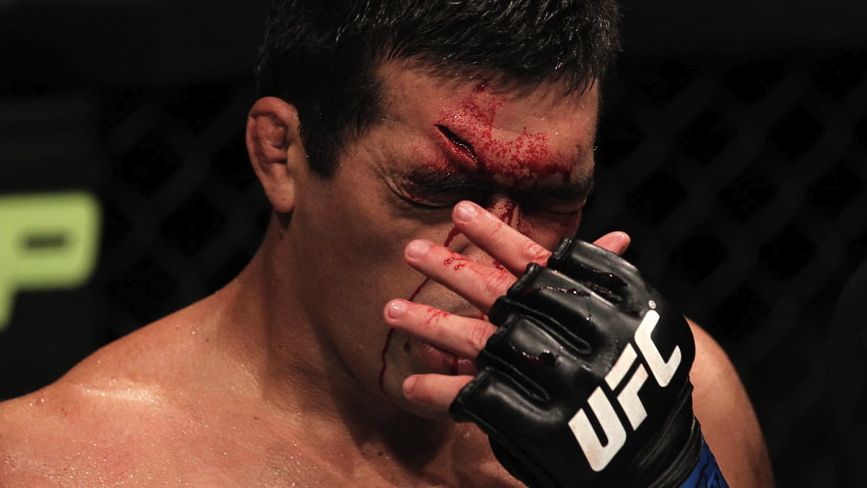 Lyoto Machida sofreu um corte profundo na testa depois de um golpe de Jon Jones