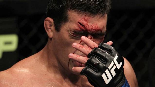 Lyoto Machida sofreu um corte profundo na testa depois de um golpe de Jon Jones