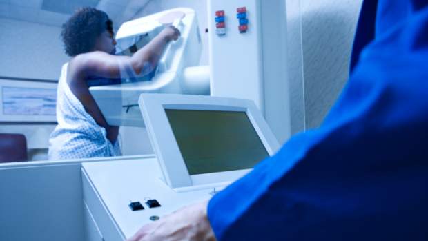 Mamografia: pesquisa ajudará a criar tratamentos personalizados