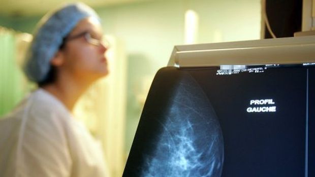 Mamografia: Nos Estados Unidos, diagnóstico de câncer de mama em fase inicial dobrou em 30 anos