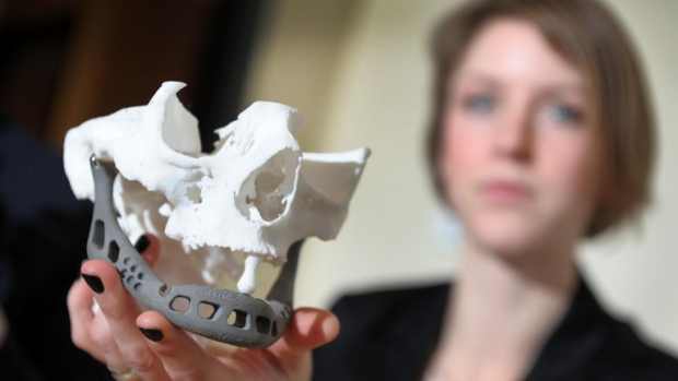 A médica Ingeborg van Kroonenburgh, da Universidade de Maastrich, na Holanda, segura a mandíbula inferior feita em uma impressora 3D