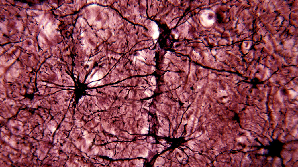 Astrócitos, células gliais em forma de estrela que fornecem nutrientes, suporte e isolamento de neurônios do sistema nervoso central