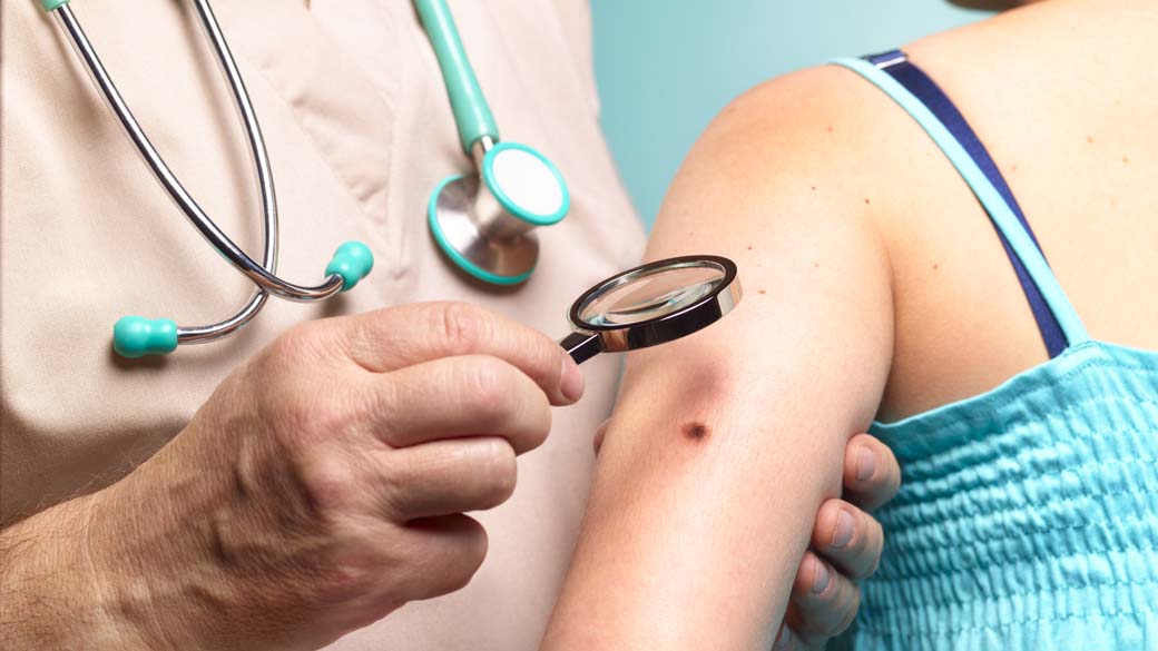 Médico examina paciente com melanoma