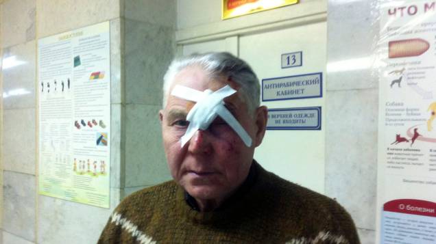 <p>Homem ferido por queda de meteorito em Tcheliabinsk, na Rússia</p>