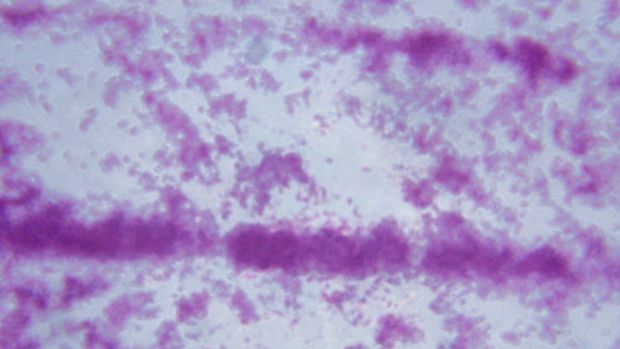 Imagem microscópica da Mycobacterium tuberculosis