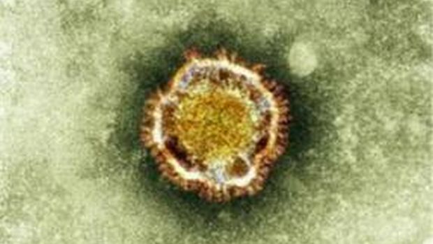 Imagem mostra o vírus NcoV, coronavírus descoberto em 2012