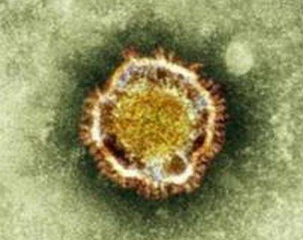 Imagem mostra o vírus NcoV, coronavírus descoberto em 2012