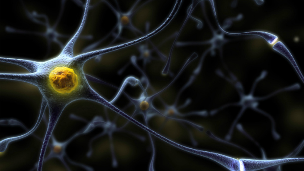 Placas amiloides bloqueiam e matam neurônios do cérebro em pacientes com Alzheimer.