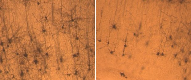 Neurônios de um rato normal (à esquerda) são mais longos e numerosos que os de um rato no qual falta a proteína SNX27 (à direita)