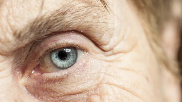 Olhos: cirurgia de catarata