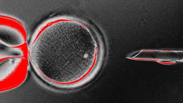 Óvulo recebe material genético de célula da pele: método revolucionário