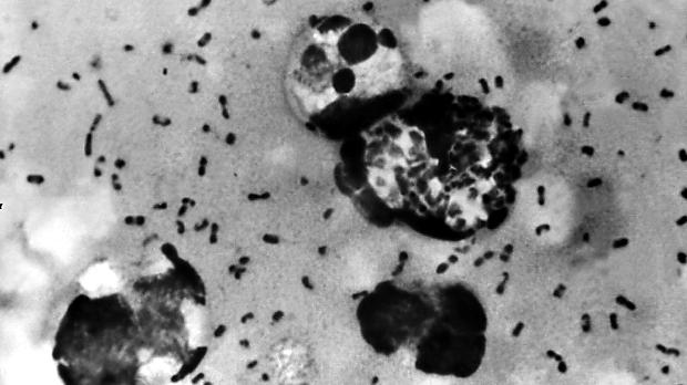 Imagem de uma cultura com organismos bacterianos causadores da peste bubônica