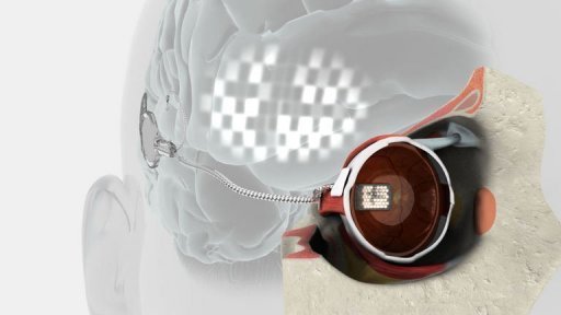 Ilustração divulgada pelo BVA de um protótipo de olho biônico