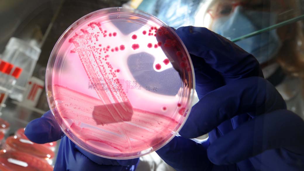 Placa de Petri com meio de cultura e estirpes de bactérias E. coli enterohemorrágica (EHEC), em hospital universitário na Alemanha