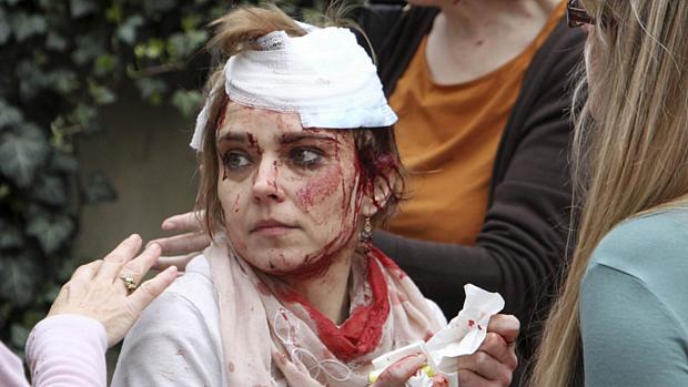 Mulher ferida na explosão no prédio da Faculdade de Cinema